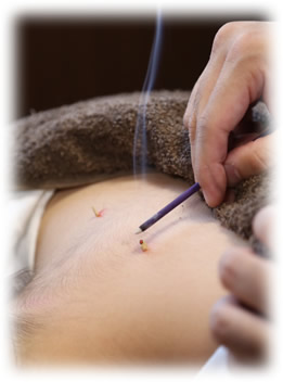 鍼灸イメージ写真